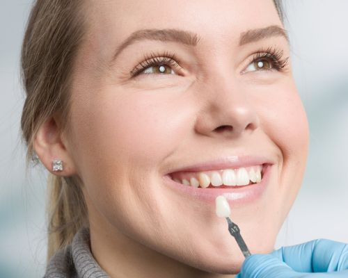 Teeth Whitening